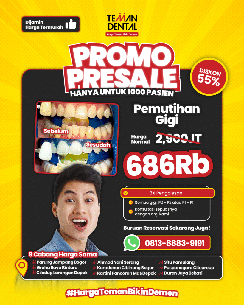 Promo Presale Bleaching termurah Rp. 686.000 hanya di klinik gigi teman dental